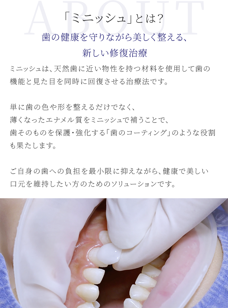 「ミニッシュ」とは？歯の健康を守りながら美しく整える、新しい修復治療 - ミニッシュは、天然歯に近い物性を持つ材料を使用して歯の機能と見た目を同時に回復させる治療法です。 | MINISH（ミニッシュ）