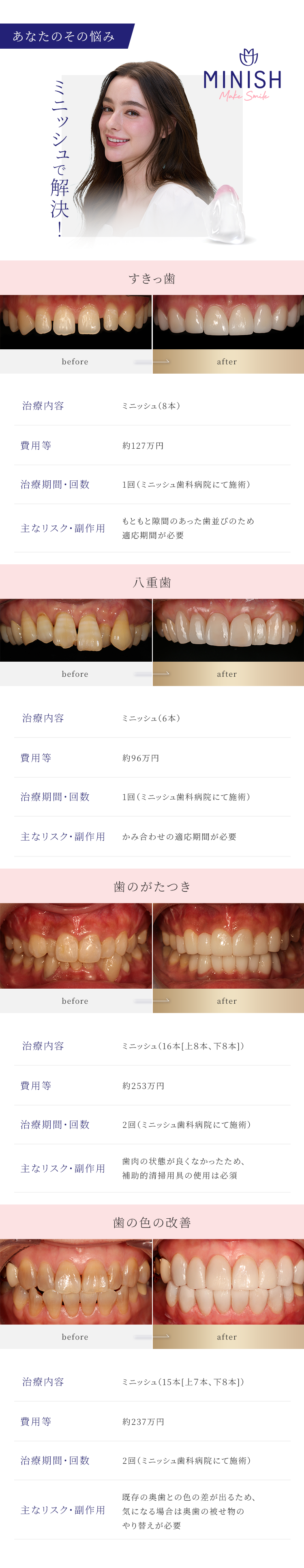 あなたのその悩みミニッシュで解決！
